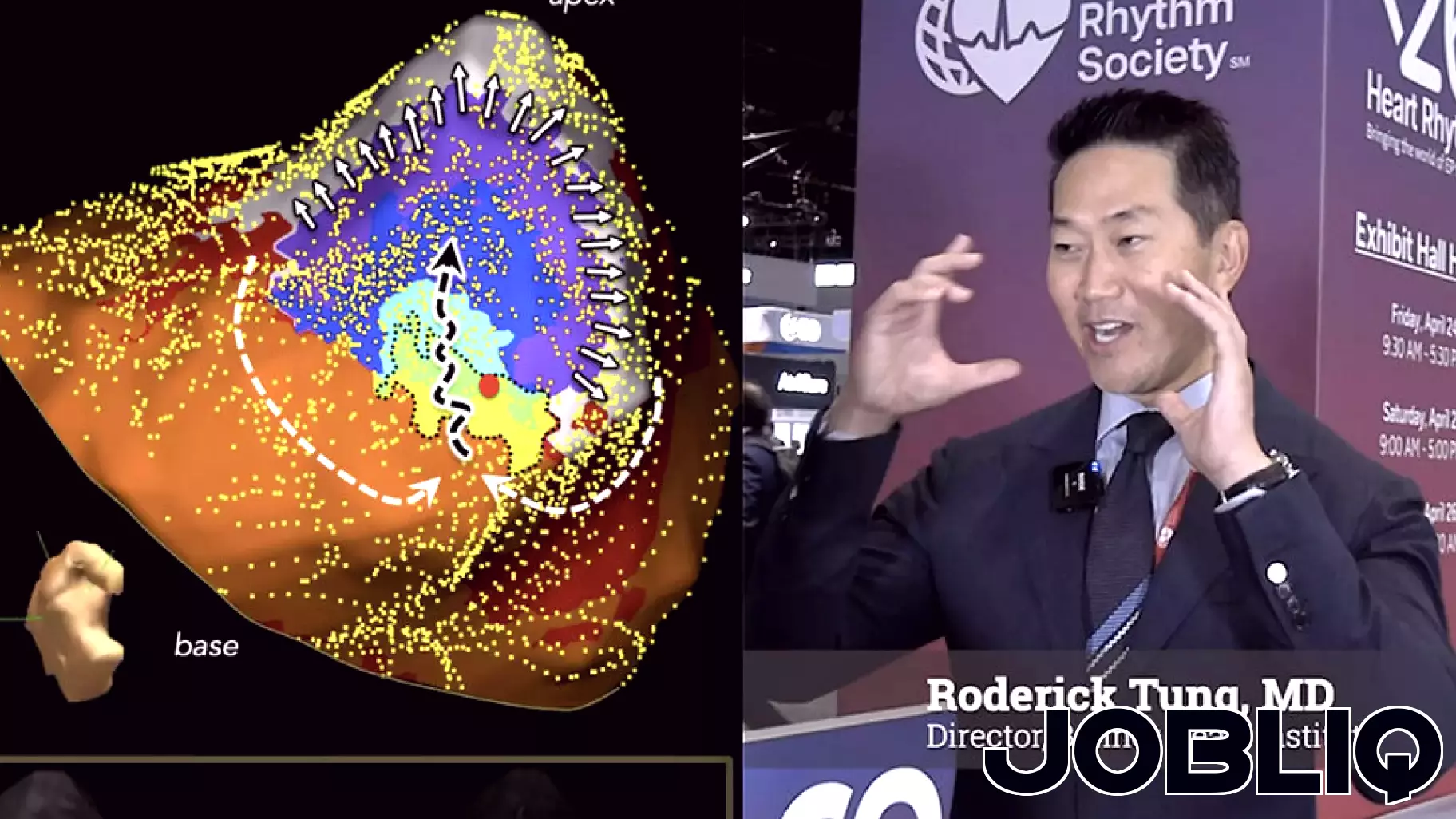 Exploring key breakthroughs in VT ablation