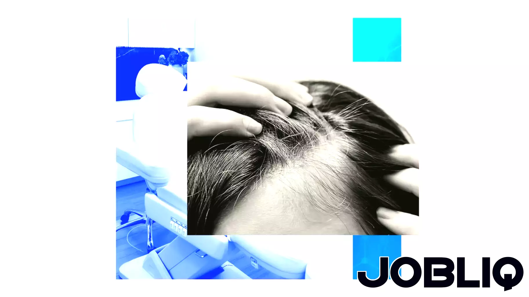 Revolutionary Laser Treatment Offers Non-Surgical Solution for Hair Loss