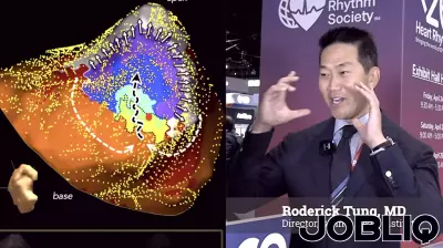 Exploring key breakthroughs in VT ablation